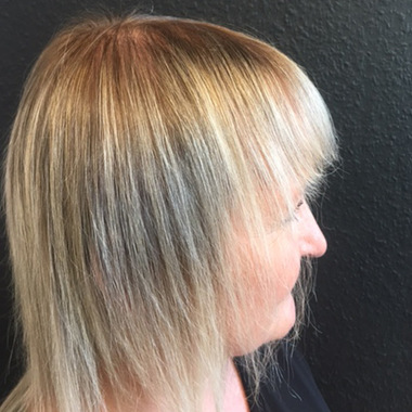 Dana vorher mit dünnem, fransigem Haar, besonders am Oberkopf:  (© © Haarstudio 39 / Great Lengths)